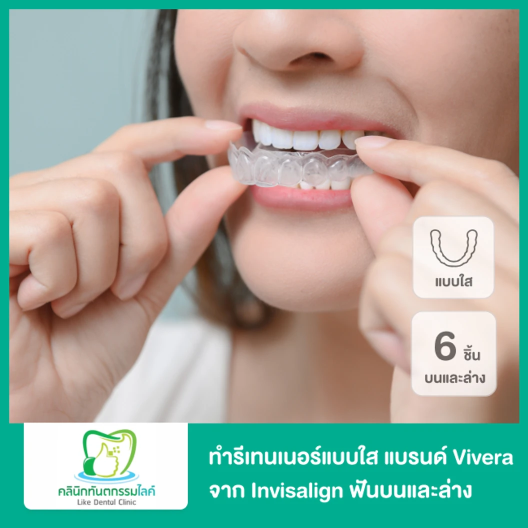 ทำรีเทนเนอร์แบบใส แบรนด์ Vivera จาก Invisalign ฟันบนและล่าง 3 คู่ 6 ชิ้นงาน ที่ Like Dental Clinic