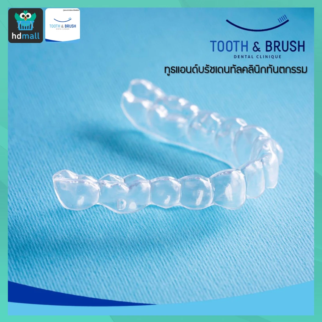 ทำรีเทนเนอร์แบบใส 1 ชิ้น ฟันบนหรือล่าง ที่ Tooth & Brush Dental Clinique