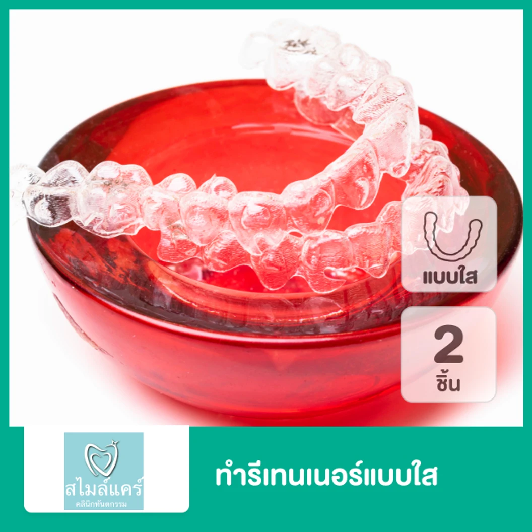 ทำรีเทนเนอร์แบบใส 2 ชิ้น ฟันบนและล่าง ที่ คลินิกทันตกรรมสไมล์แคร์ สมุทรปราการ
