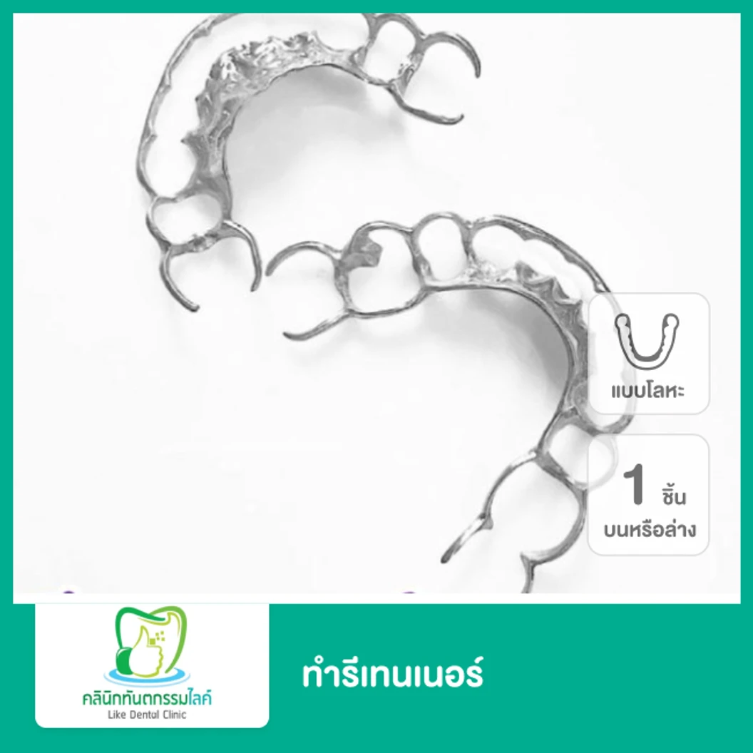 ทำรีเทนเนอร์แบบโลหะ 1 ชิ้น ฟันบนหรือล่าง ที่ Like Dental Clinic