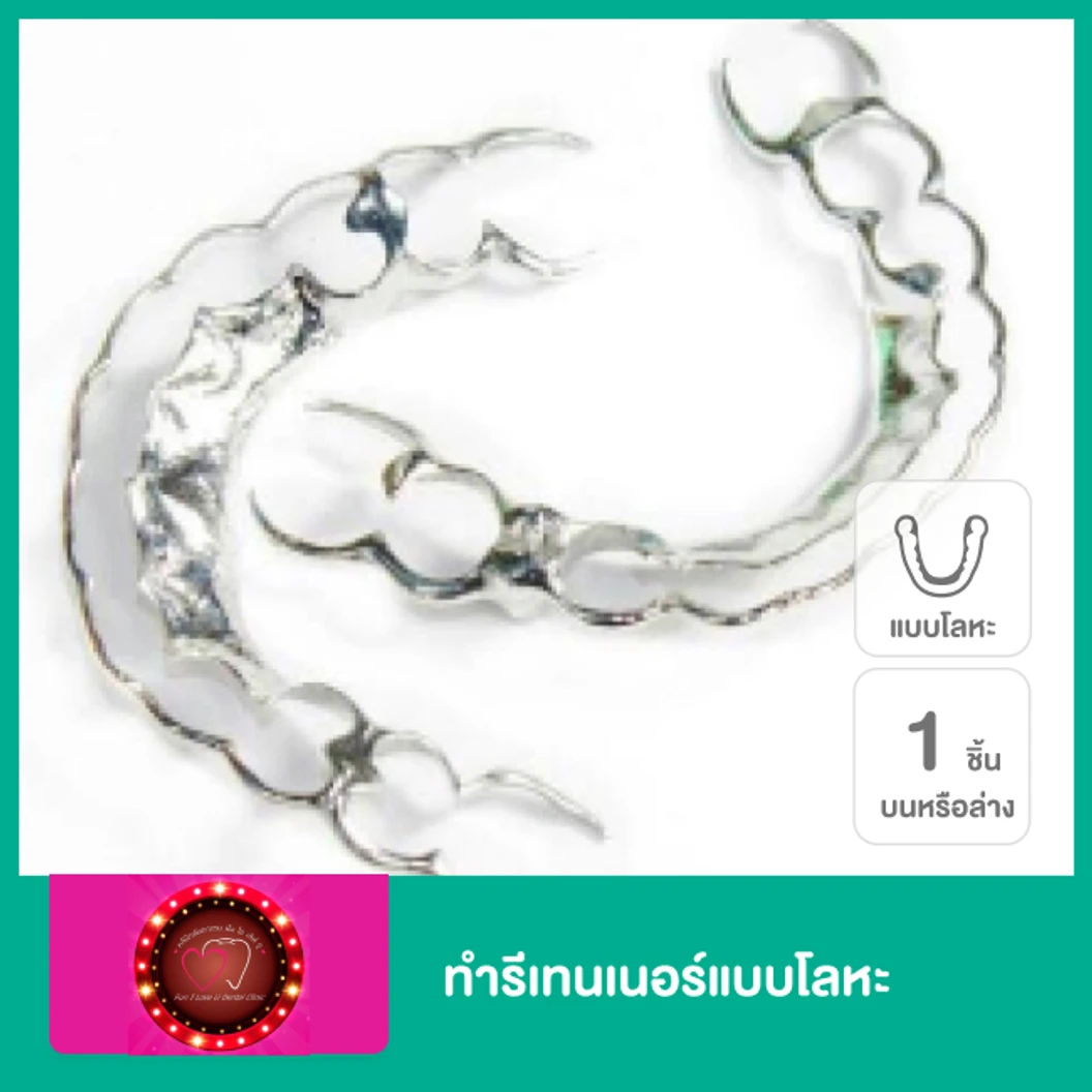 ทำรีเทนเนอร์แบบโลหะ 1 ชิ้น ฟันบนหรือล่าง ที่ คลินิกทันตกรรม ฟัน ไอ เลิฟ ยู