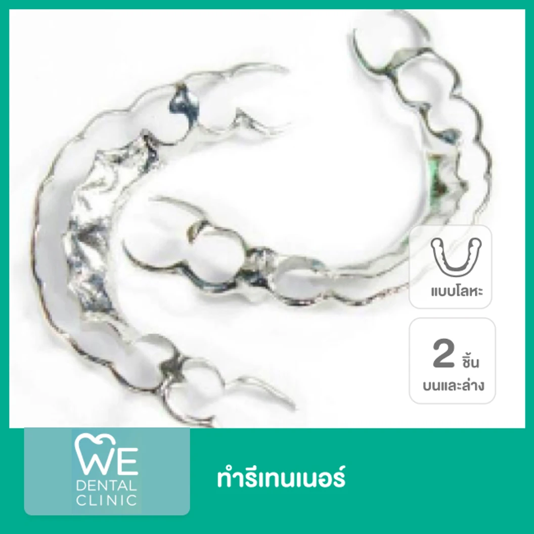ทำรีเทนเนอร์ แบบโลหะ 2 ชิ้น ฟันบนและล่าง ที่ WE Dental Clinic
