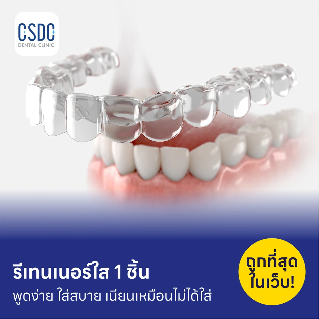 ทำรีเทนเนอร์แบบใส 1 ชิ้น ฟันบนหรือล่าง แพ็กเกจ HDmall+ ที่ CSDC