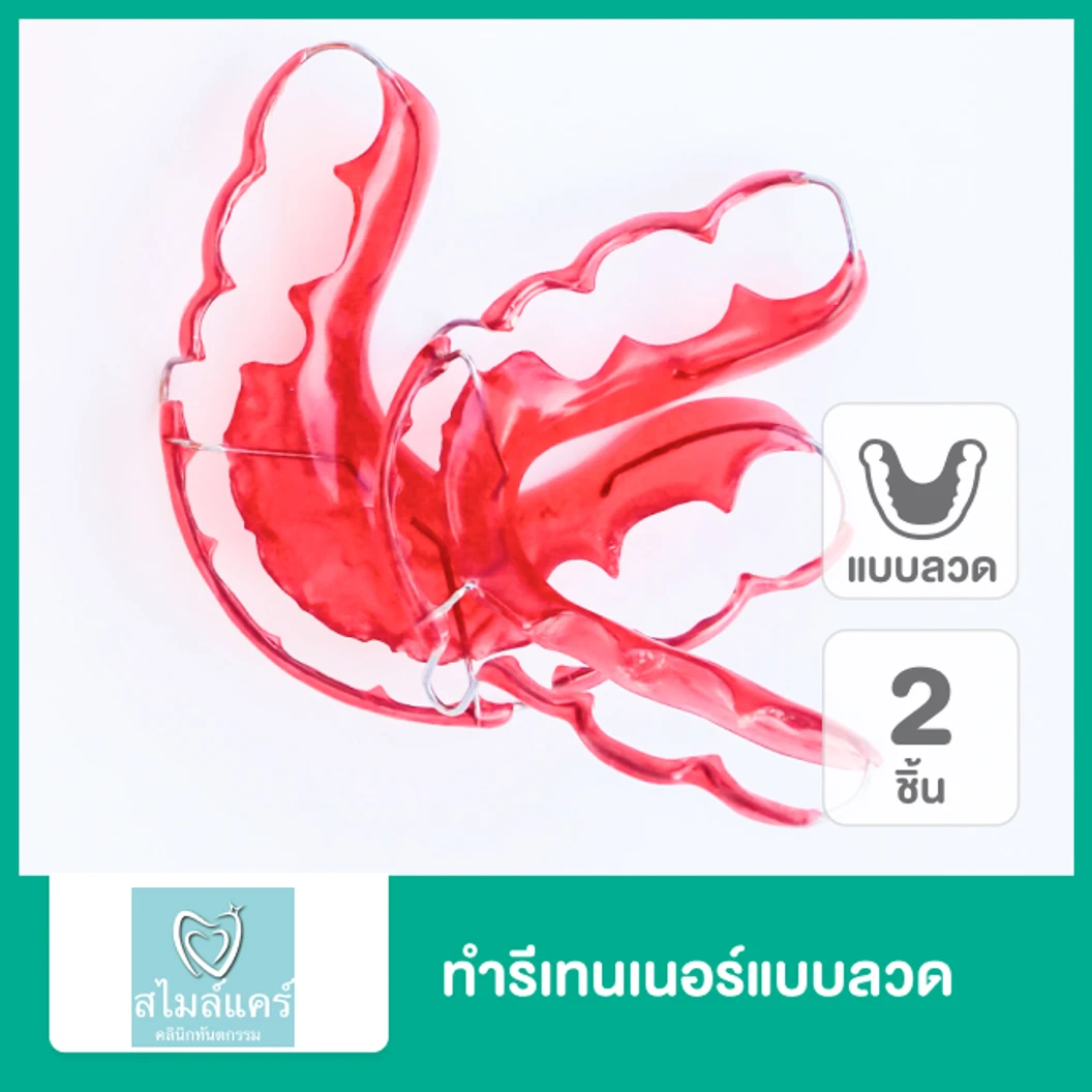 ทำรีเทนเนอร์แบบลวด 2 ชิ้น ฟันบนและล่าง ที่ คลินิกทันตกรรมสไมล์แคร์ สมุทรปราการ