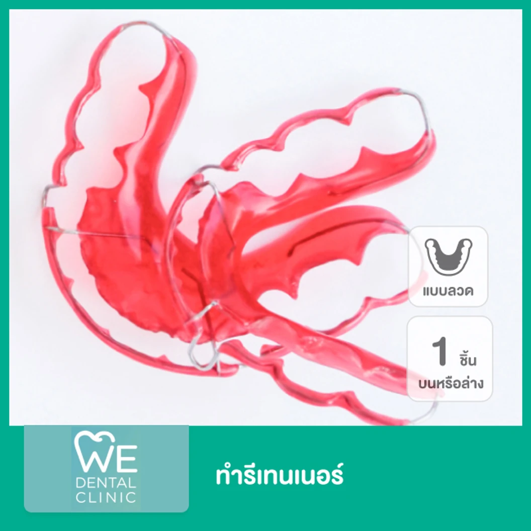 ทำรีเทนเนอร์ แบบลวด 1 ชิ้น ฟันบนหรือล่าง ที่ WE Dental Clinic