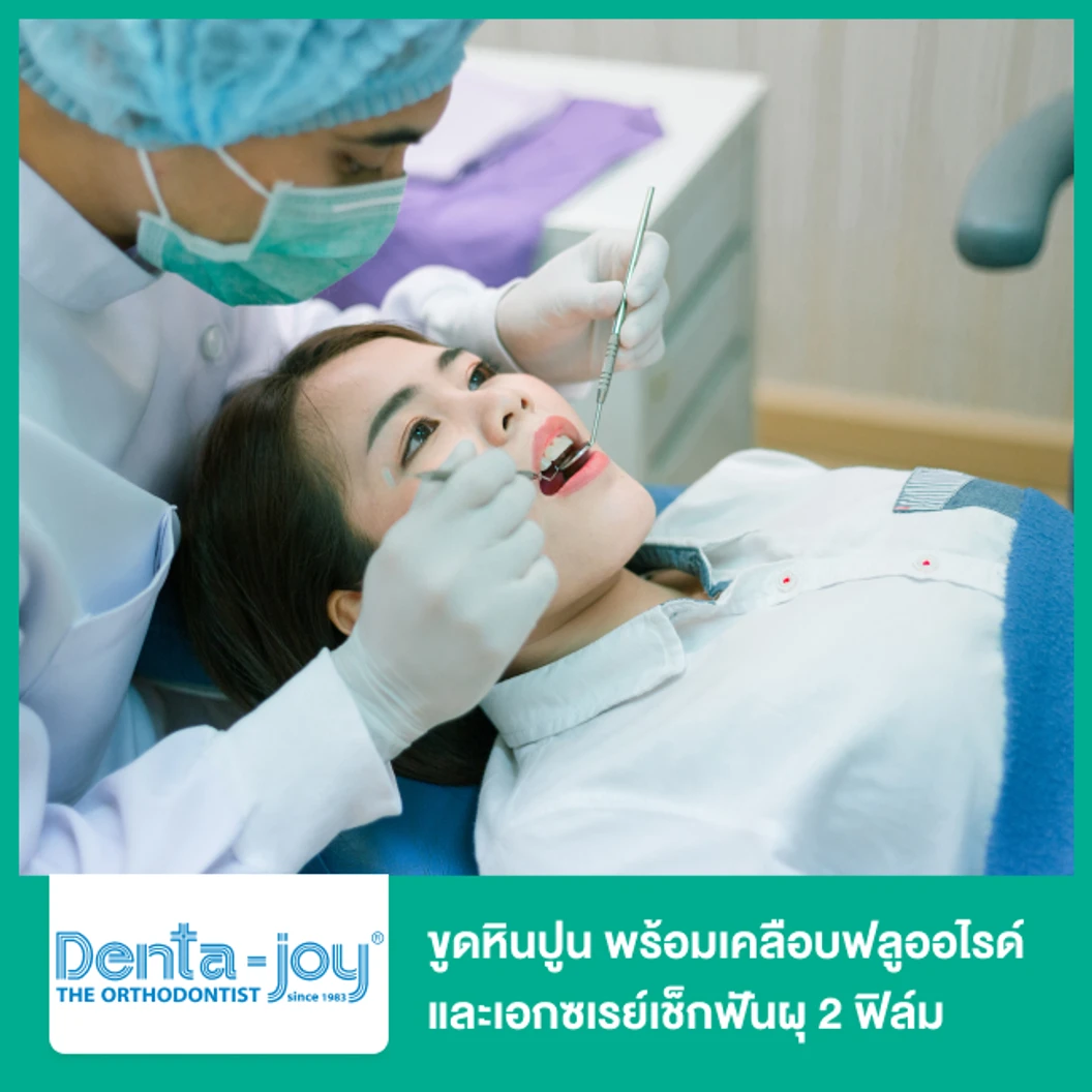 ขูดหินปูน พร้อมเคลือบฟลูออไรด์ และเอกซเรย์เช็กฟันผุ 2 ฟิล์ม ที่ Dentajoy