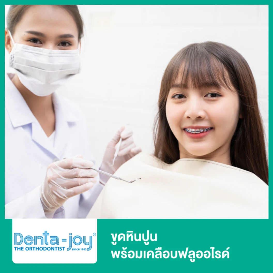 ขูดหินปูน พร้อมเคลือบฟลูออไรด์ ที่ Dentajoy