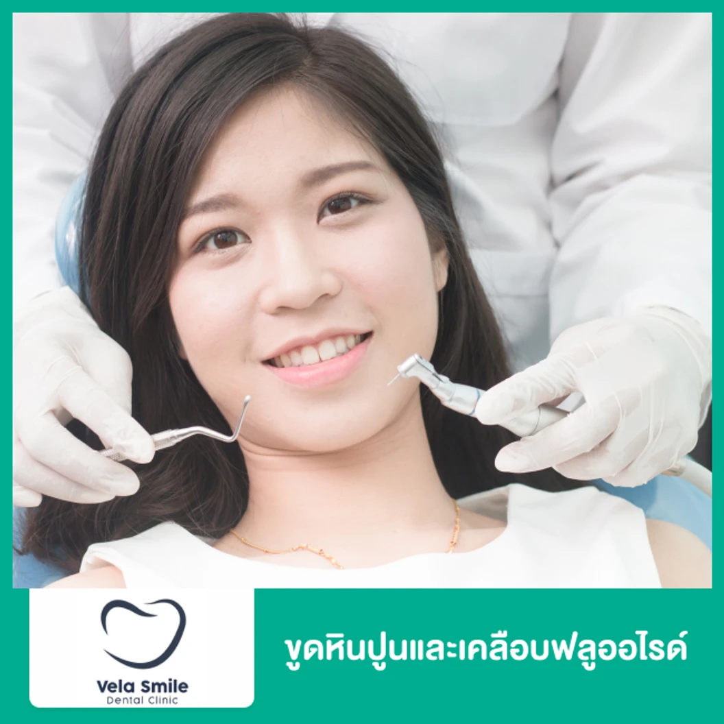 ขูดหินปูนและเคลือบฟลูออไรด์ ที่ Vela Smilee Dental Clinic