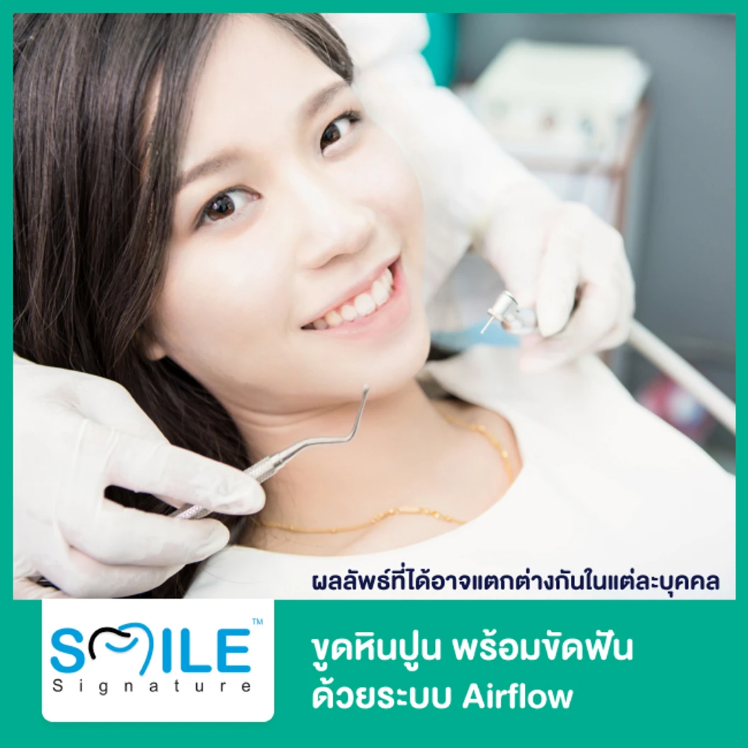 ขูดหินปูน พร้อมขัดฟันด้วยระบบ Airflow ที่ Smile Signature คลินิกทันตกรรมสไมล์ ซิกเนเจอร์