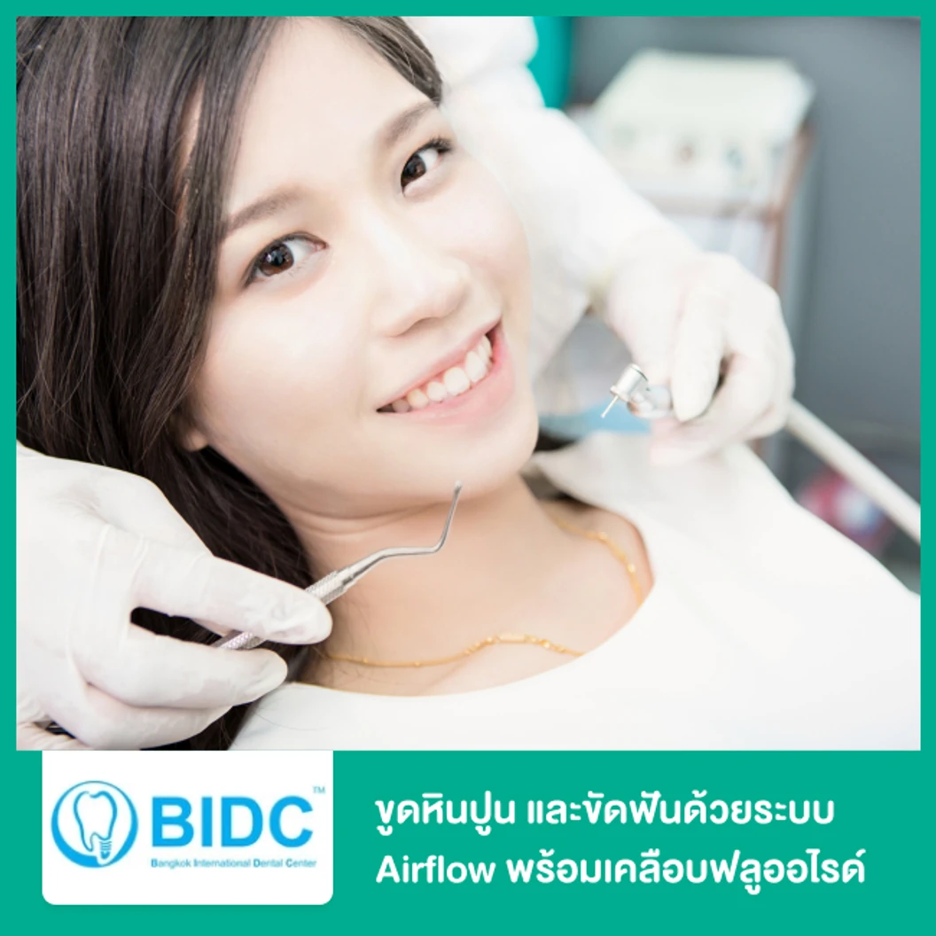 ขูดหินปูน และขัดฟันด้วยระบบ Airflow พร้อมเคลือบฟลูออไรด์ ที่ BIDC Dental Center BIDC