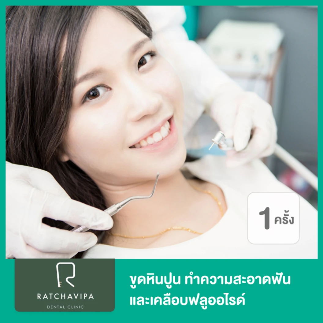 ขูดหินปูน ทําความสะอาดฟัน และเคลือบฟลูออไรด์ 1 ครั้ง ที่ Ratchavipa Dental Clinic คลินิกทันตกรรมรัชวิภา