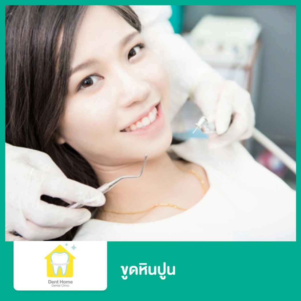 ขูดหินปูน ที่ คลินิกทันตกรรมเด้นท์โฮม