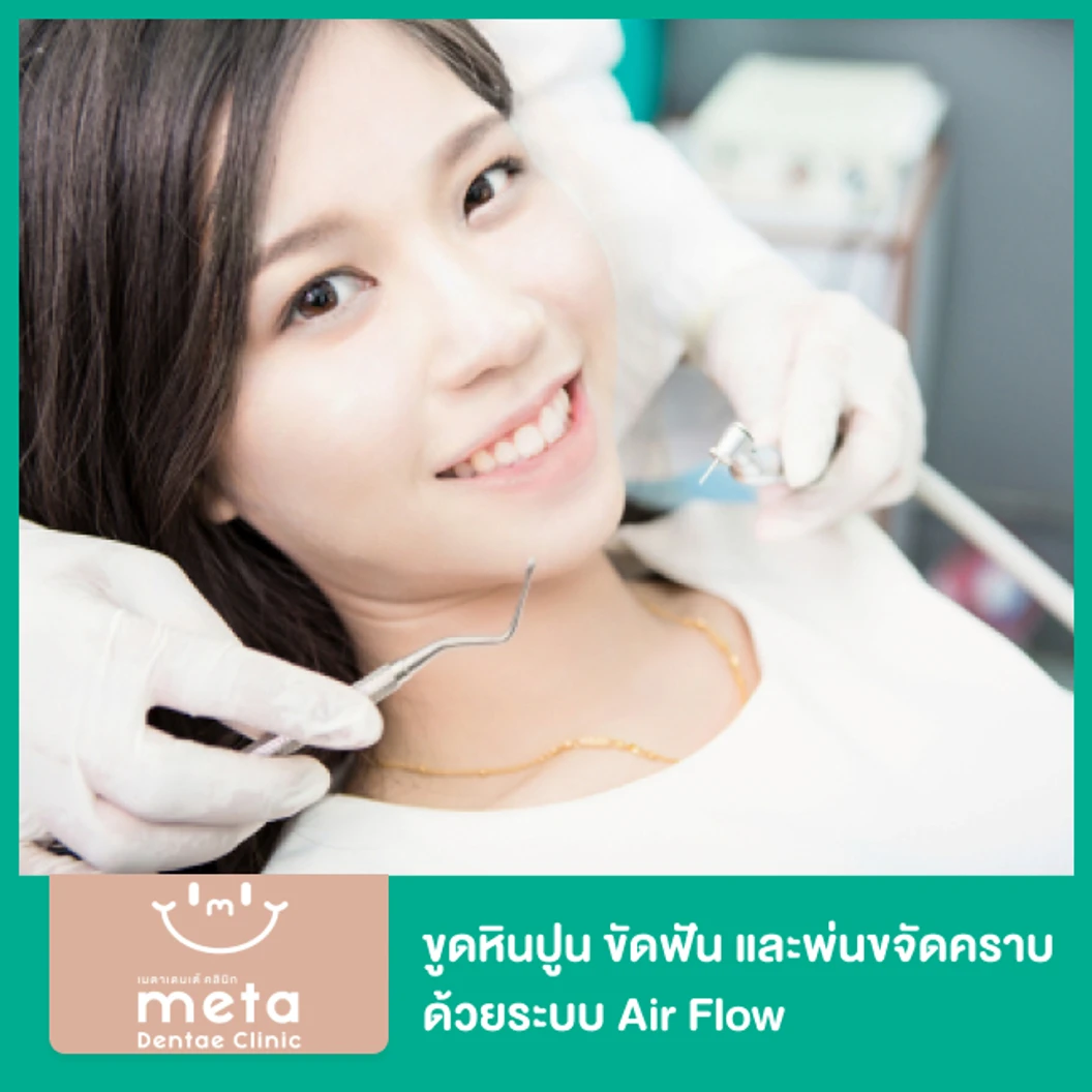 ขูดหินปูน ขัดฟัน และพ่นขจัดคราบด้วยระบบ Air Flow โปรขจัดคราบกาแฟ ที่ Meta Dentae Clinic