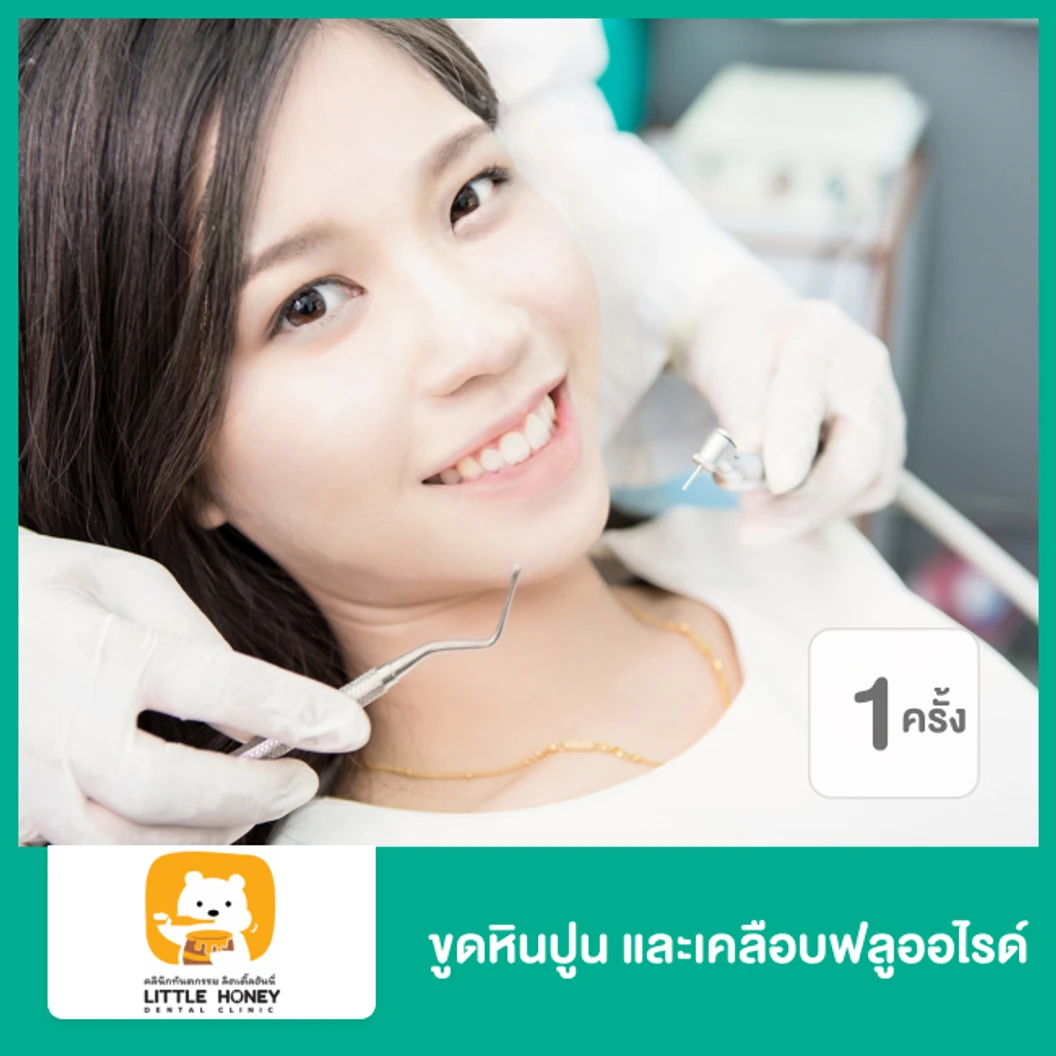 ขูดหินปูน ด้วยเครื่อง Ultrasonic P5 และเคลือบฟลูออไรด์ 1 ครั้ง ที่ Little Honey Dental Clinic