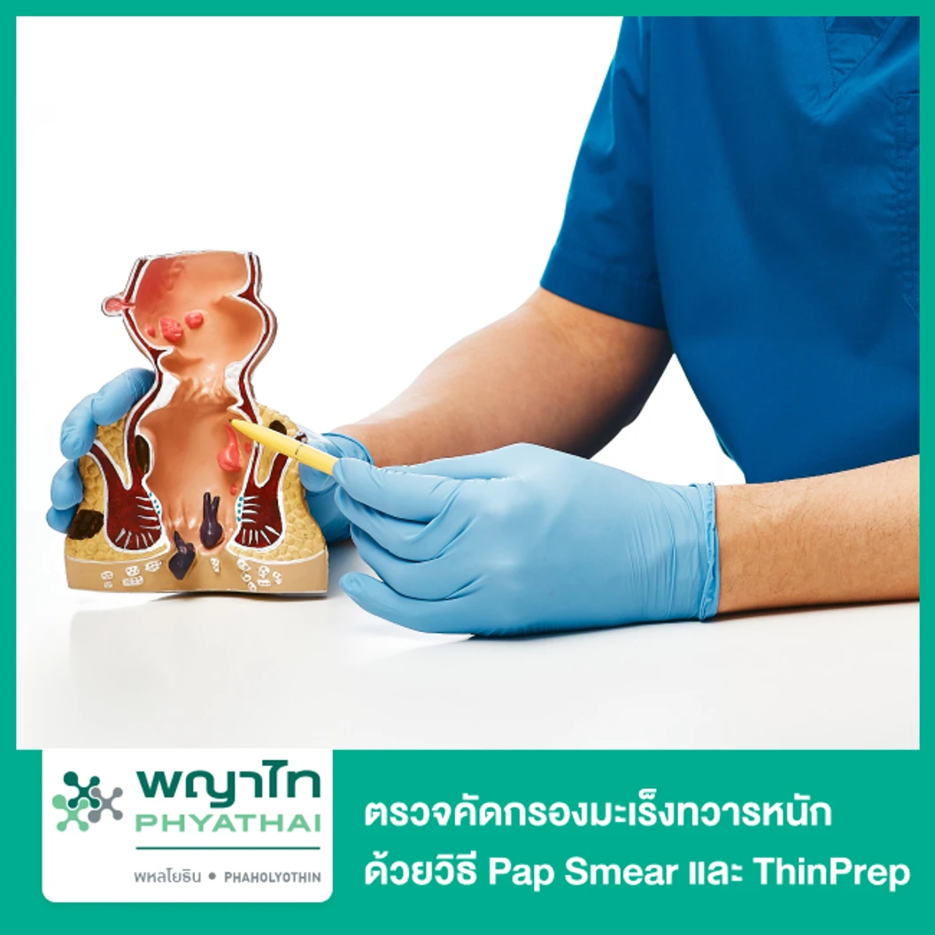 ตรวจคัดกรองมะเร็งทวารหนัก ด้วยวิธี Pap Smear และ ThinPrep ที่ โรงพยาบาลพญาไท พหลโยธิน