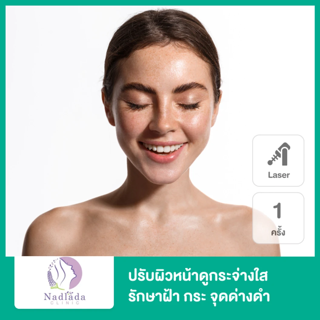 ปรับผิวหน้าดูกระจ่างใส รักษาฝ้า กระ จุดด่างดำ ด้วยเลเซอร์ Picosecond 1 ครั้ง ที่ Nadlada Clinic