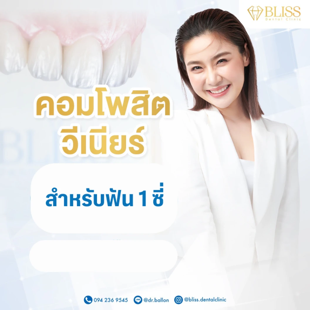 เคลือบผิวฟันและแปะฟันขาว ด้วยวีเนียร์คอมโพสิต 1 ซี่ ที่ Bliss Dental Clinic