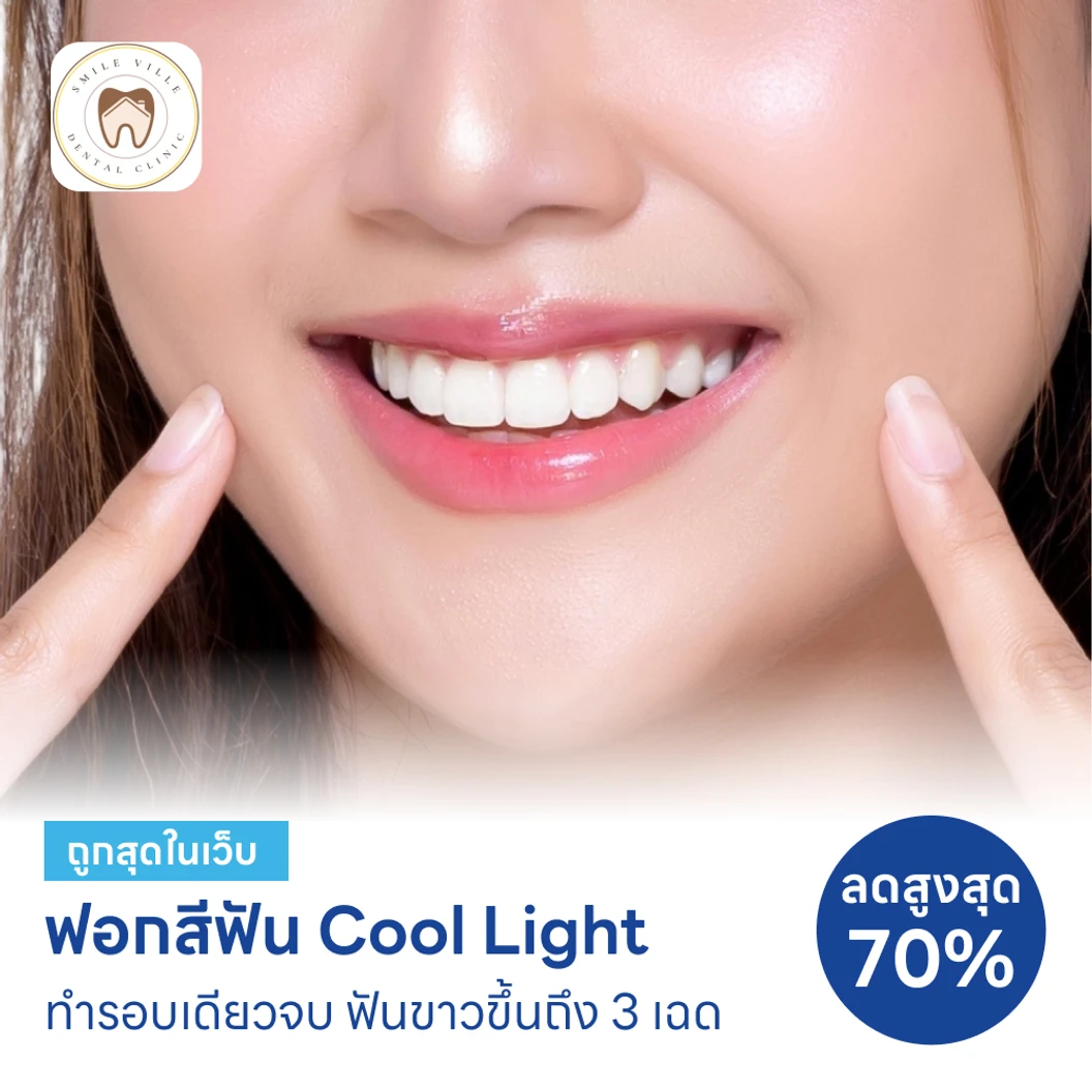 ฟอกสีฟันที่คลินิก ด้วยระบบ Cool Light แพ็กเกจ HDmall+ ที่ Smile Ville Dental Clinic