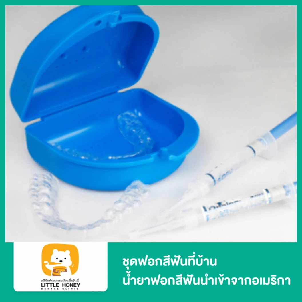 ชุดฟอกสีฟันที่บ้าน น้ำยาฟอกสีฟันนำเข้าจากอเมริกา ที่ Little Honey Dental Clinic