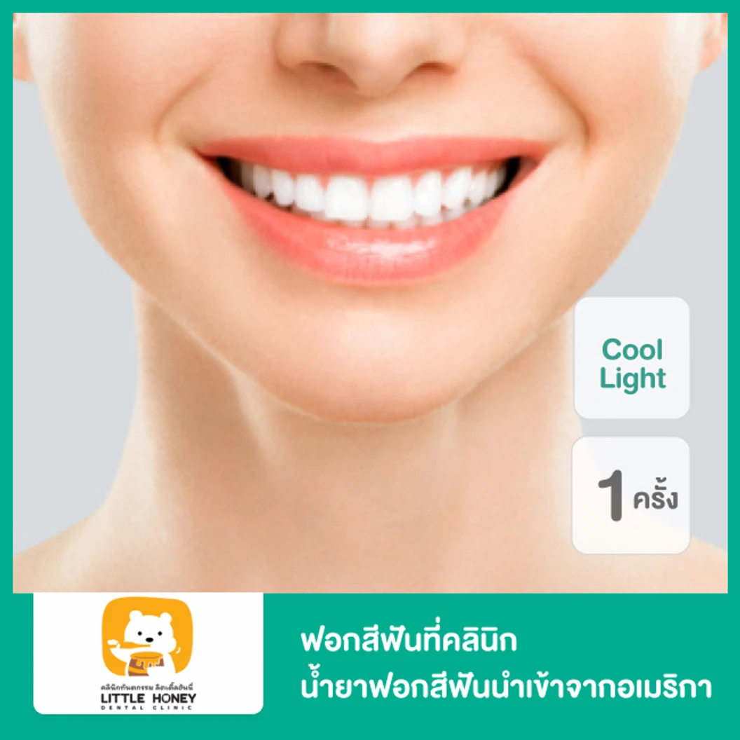 ฟอกสีฟันที่คลินิก ด้วยระบบ Cool Light น้ำยาฟอกสีฟันนำเข้าจากอเมริกา 1 ครั้ง ที่ Little Honey Dental Clinic