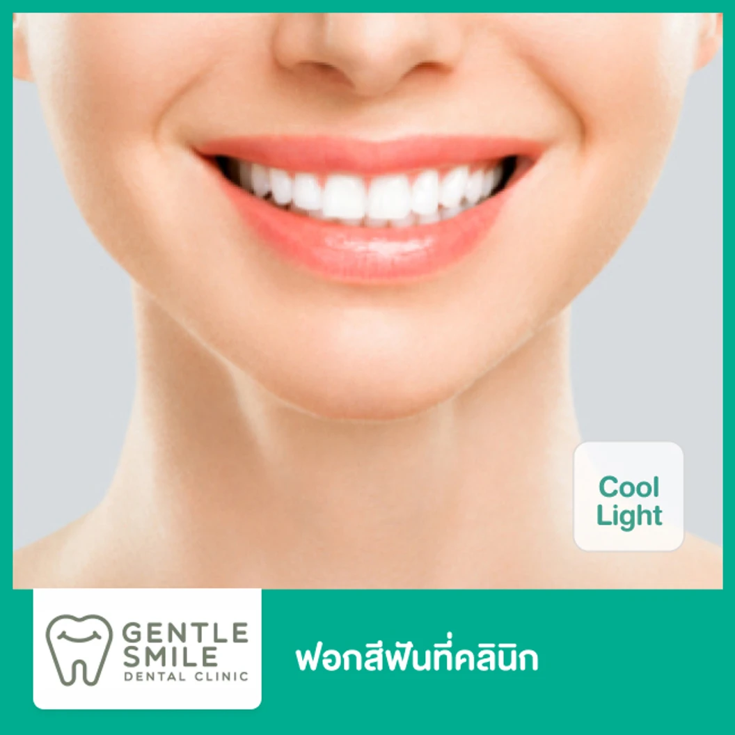 ฟอกสีฟันที่คลินิก ด้วยระบบ Cool Light ที่ Gentle Smile Dental Clinic