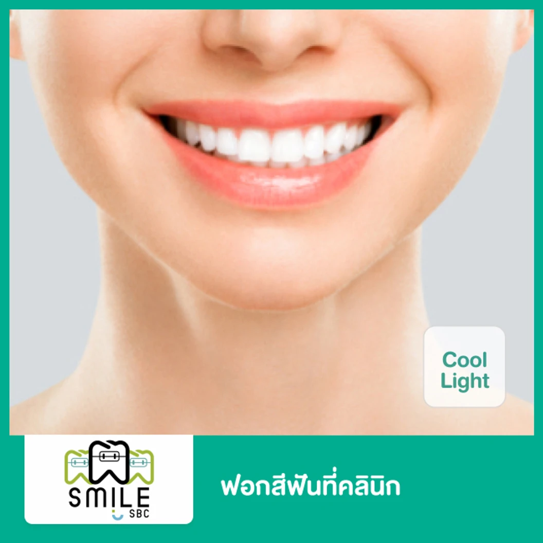 ฟอกสีฟันที่คลินิก ด้วยระบบ Cool Light ที่ SmileSBC