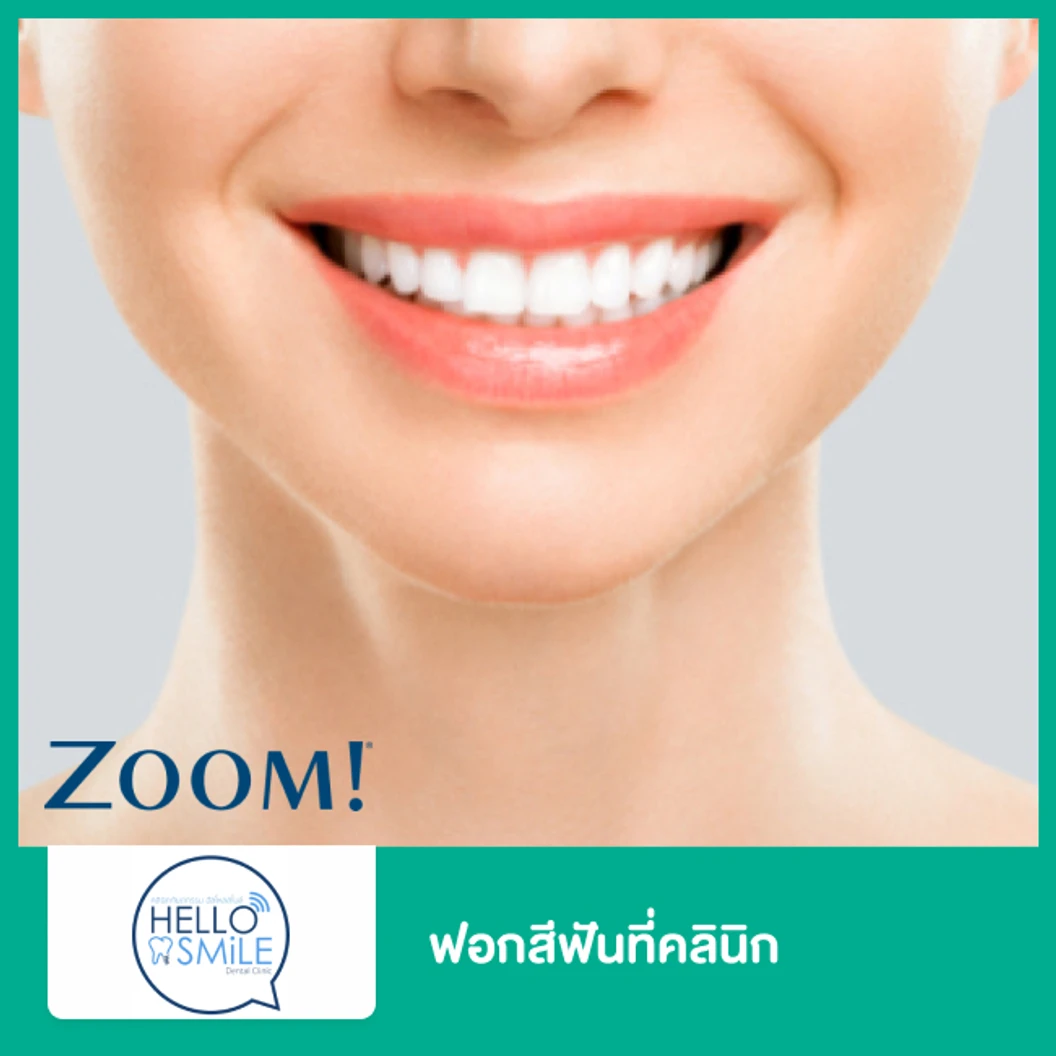 ฟอกสีฟันที่คลินิก ด้วยระบบ Zoom ที่ Hello Smile Dental Clinic