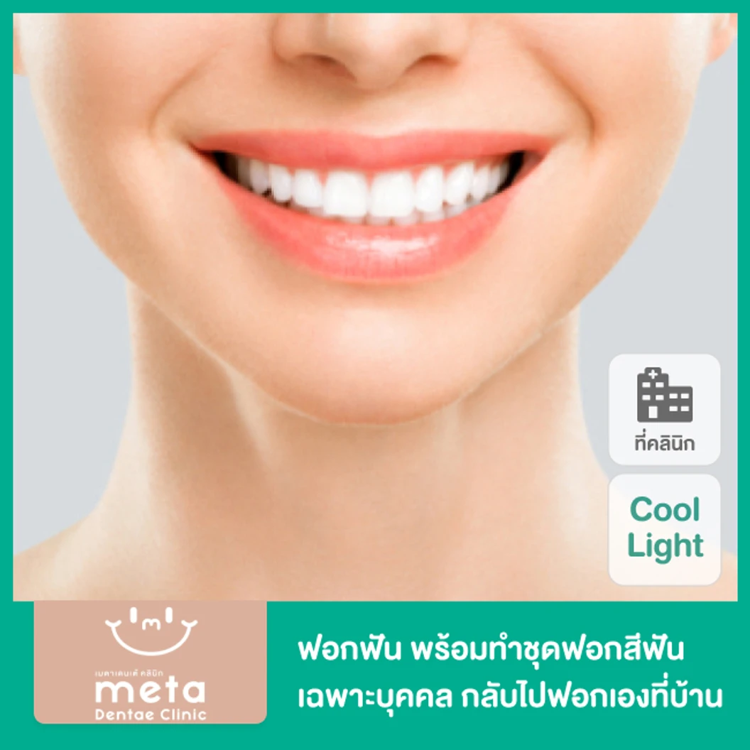ฟอกสีฟันที่คลินิกด้วยระบบ Cool Light พร้อมทำชุดฟอกสีฟันเฉพาะบุคคลกลับไปฟอกเองที่บ้าน ที่ Meta Dentae Clinic