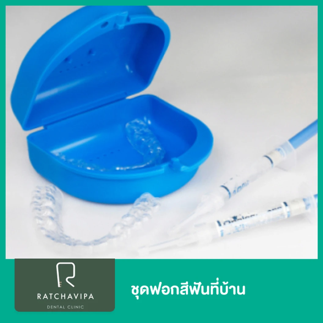 ชุดฟอกสีฟันที่บ้าน ที่ Ratchavipa Dental Clinic คลินิกทันตกรรมรัชวิภา