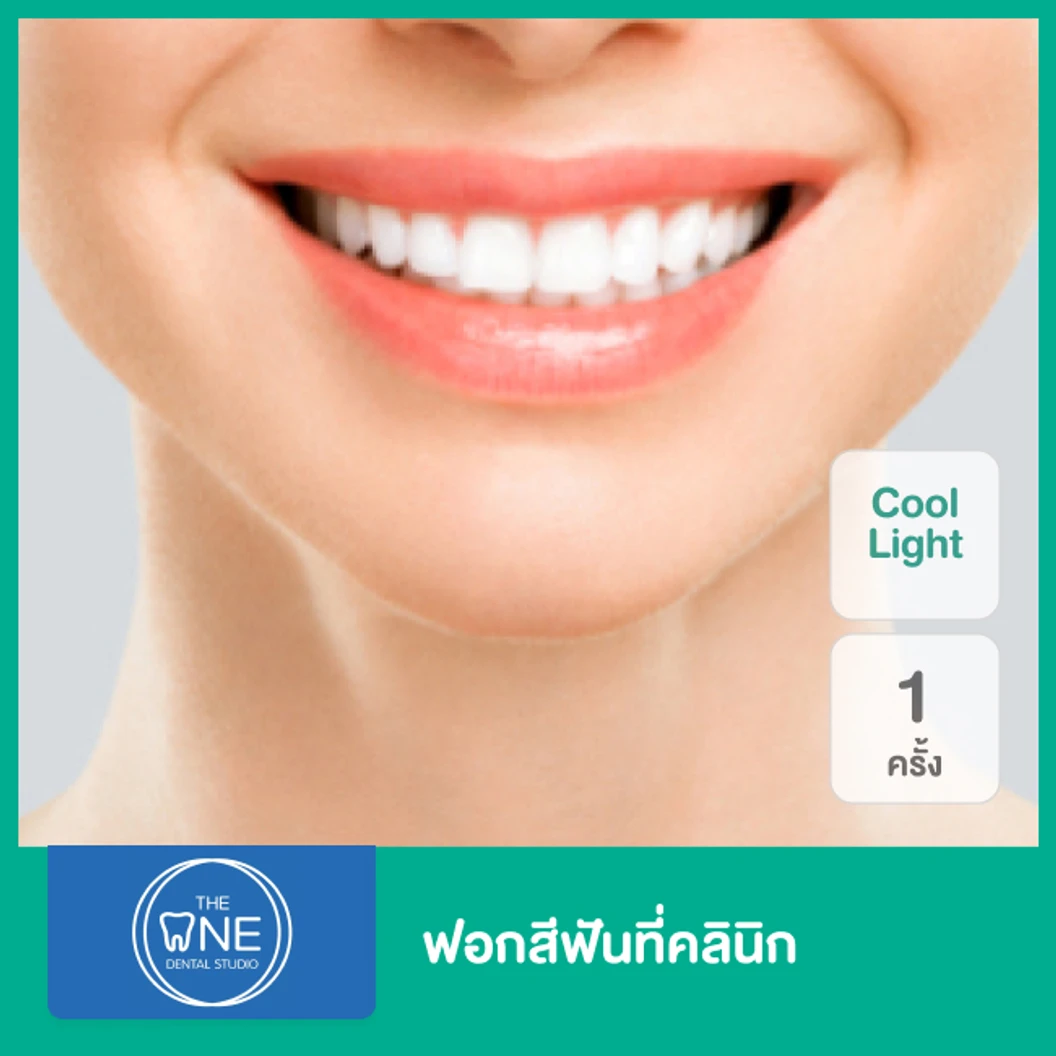ฟอกสีฟันที่คลินิก ด้วยระบบ Cool Light 1 ครั้ง ที่ The One Dental Studio