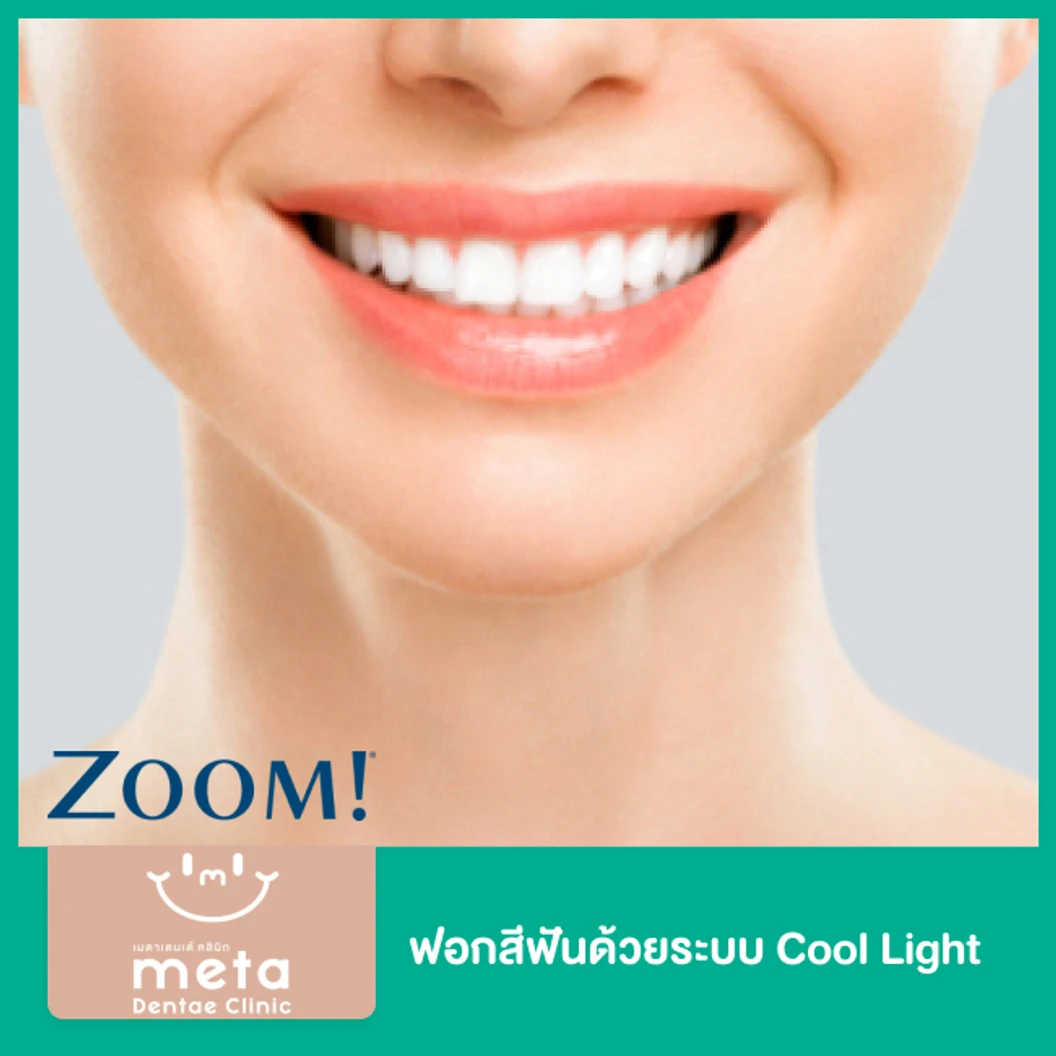 ฟอกสีฟันด้วยระบบ Cool Light ที่ Meta Dentae Clinic