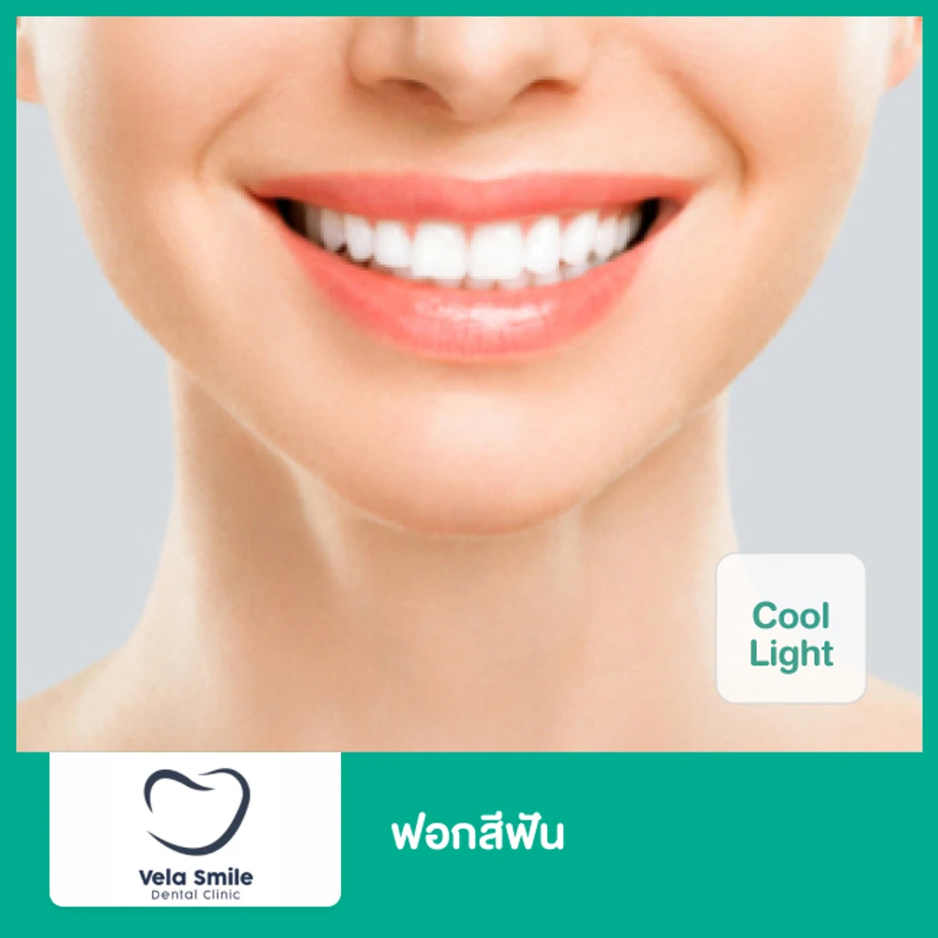 ฟอกสีฟันที่คลินิก ด้วยระบบ Cool Light ที่ Vela Smilee Dental Clinic