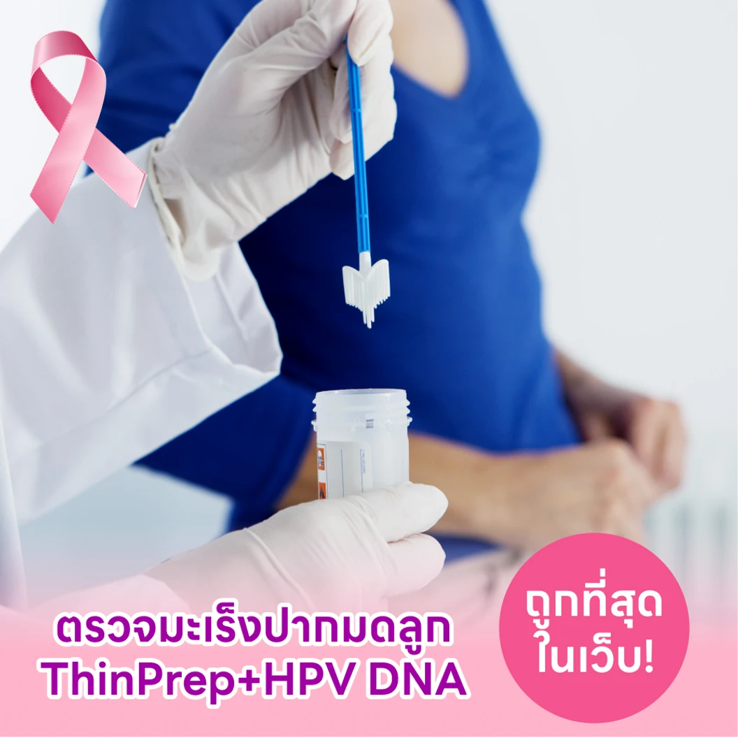 ตรวจมะเร็งปากมดลูก ThinPrep และตรวจหาเชื้อ HPV ด้วย DNA แพ็กเกจ HDmall+ ที่ โรงพยาบาลวิมุต-เทพธารินทร์ พระราม 4