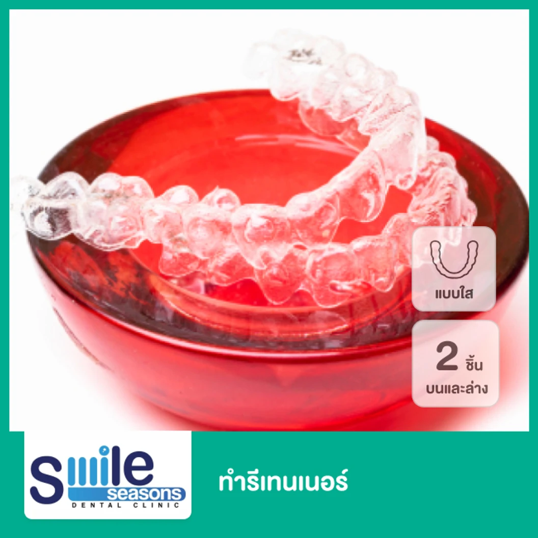 ทำรีเทนเนอร์แบบใส 2 ชิ้น ฟันบนและล่าง  ที่ Smile Seasons Dental Clinic คลินิกทันตกรรมสไมล์ซีซันส์