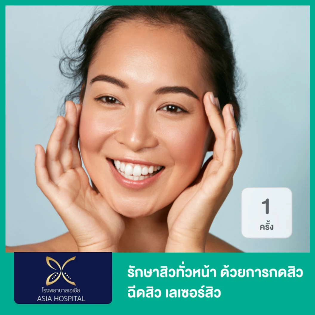 รักษาสิวทั่วหน้า ด้วยการกดสิว ฉีดสิว เลเซอร์สิว 1 ครั้ง ที่ โรงพยาบาลเอเซีย