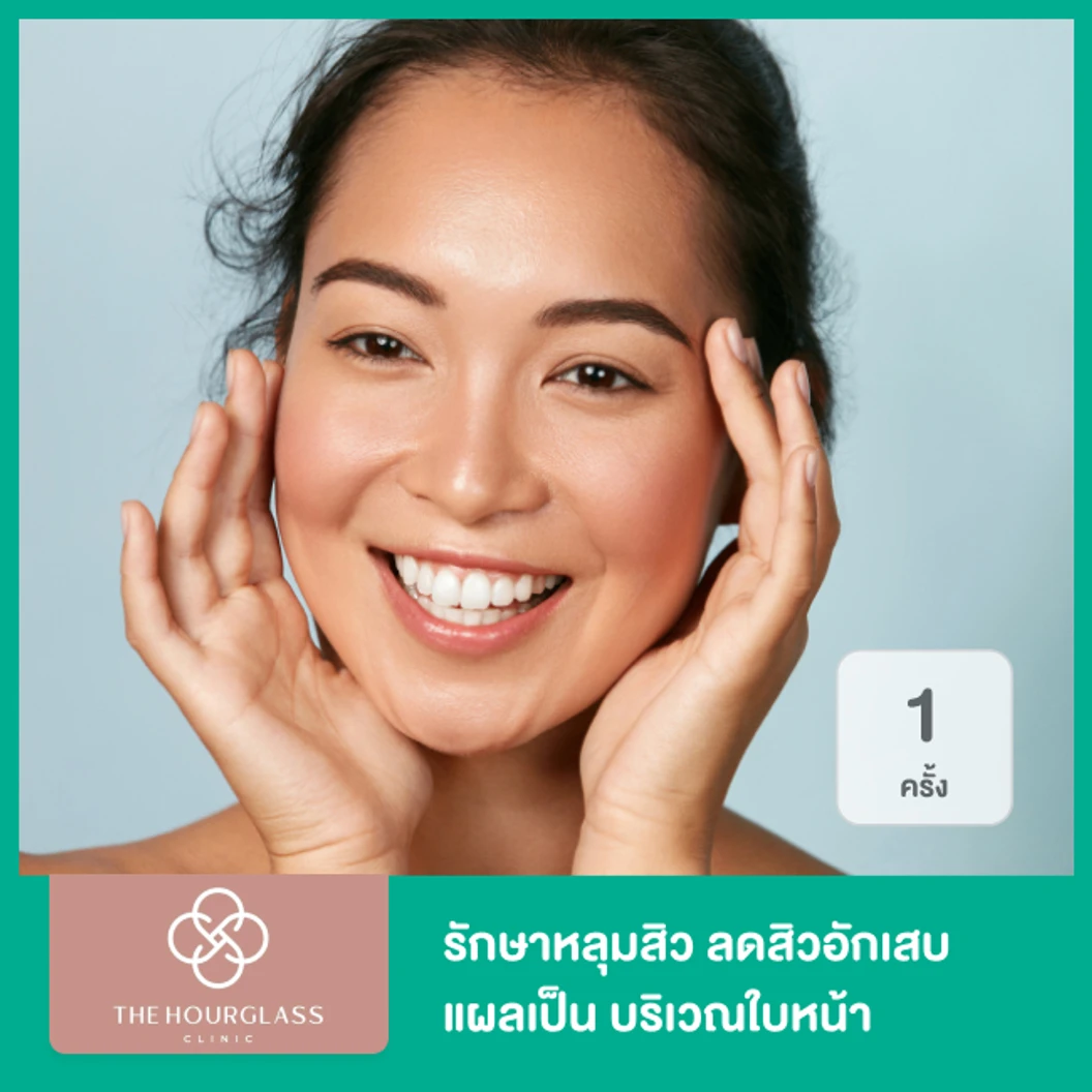รักษาหลุมสิว ลดสิวอักเสบ แผลเป็น ด้วย Microneedle เครื่อง Scar Clear บริเวณใบหน้า 1 ครั้ง ที่ The Hourglass Clinic