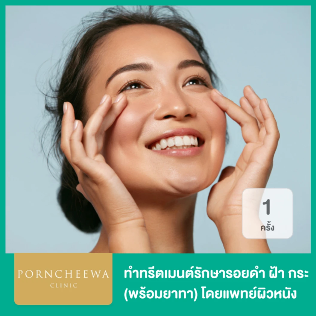 ทำทรีตเมนต์รักษารอยดำ ฝ้า กระ พร้อมยาทา โดยแพทย์ผิวหนัง 1 ครั้ง ที่ Porncheewa Clinic