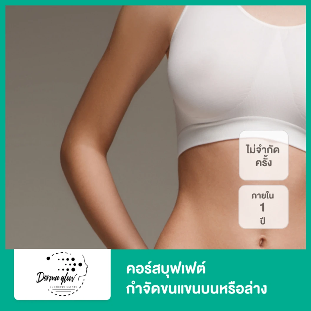 คอร์สบุฟเฟต์กำจัดขนแขนบนหรือล่าง ด้วยเลเซอร์ YAG ไม่จำกัดครั้ง ภายใน 1 ปี ที่ DermaGlow Clinic