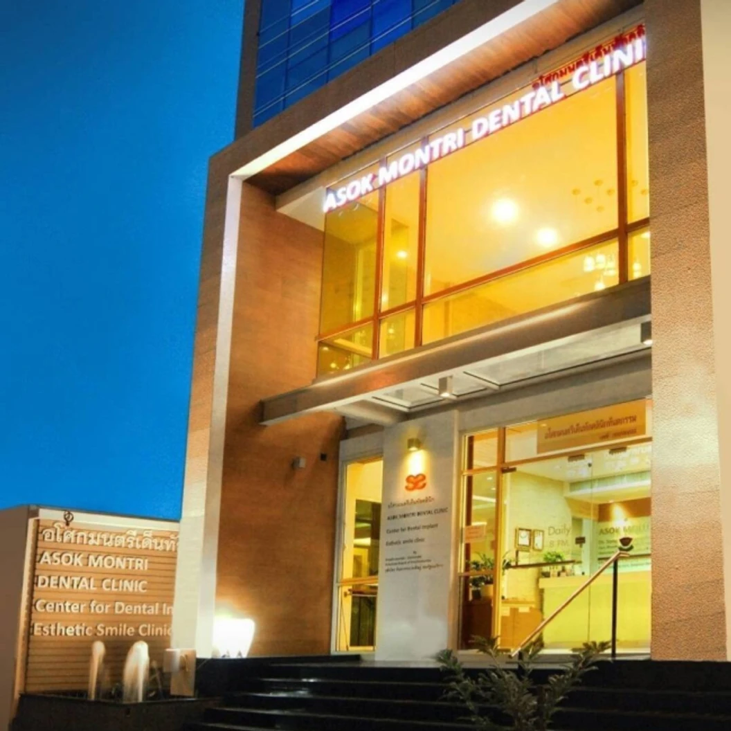 เคลือบผิวฟันและแปะฟันขาว ด้วยวีเนียร์คอมโพสิต 1 ซี่ ที่ Asoke Montri Dental Clinic อโศกมนตรีเด็นทัลคลินิก