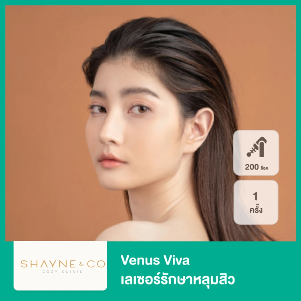 Venus Viva เลเซอร์รักษาหลุมสิว 200 ช็อต 1 ครั้ง ที่ Shayne & Co. Clinic