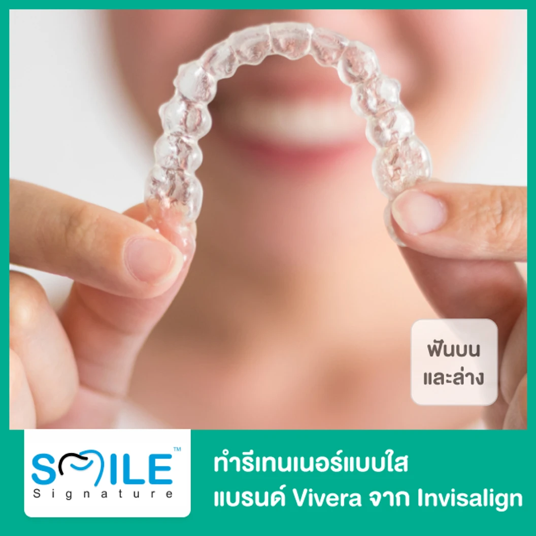 ทำรีเทนเนอร์แบบใส แบรนด์ Vivera จาก Invisalign ฟันบนและล่าง 3 คู่ ที่ Smile Signature คลินิกทันตกรรมสไมล์ ซิกเนเจอร์