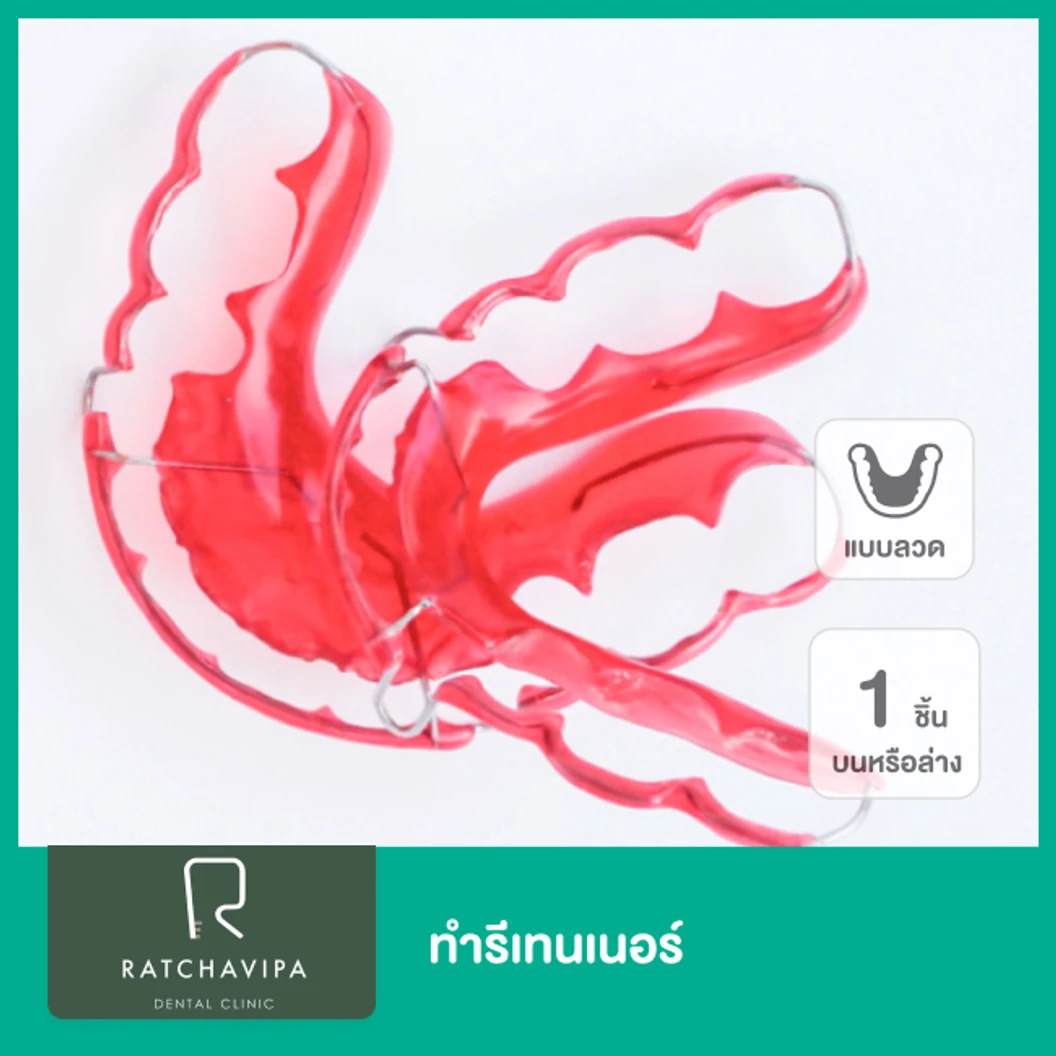 ทำรีเทนเนอร์แบบลวด 1 ชิ้น ฟันบนหรือล่าง ที่ Ratchavipa Dental Clinic คลินิกทันตกรรมรัชวิภา