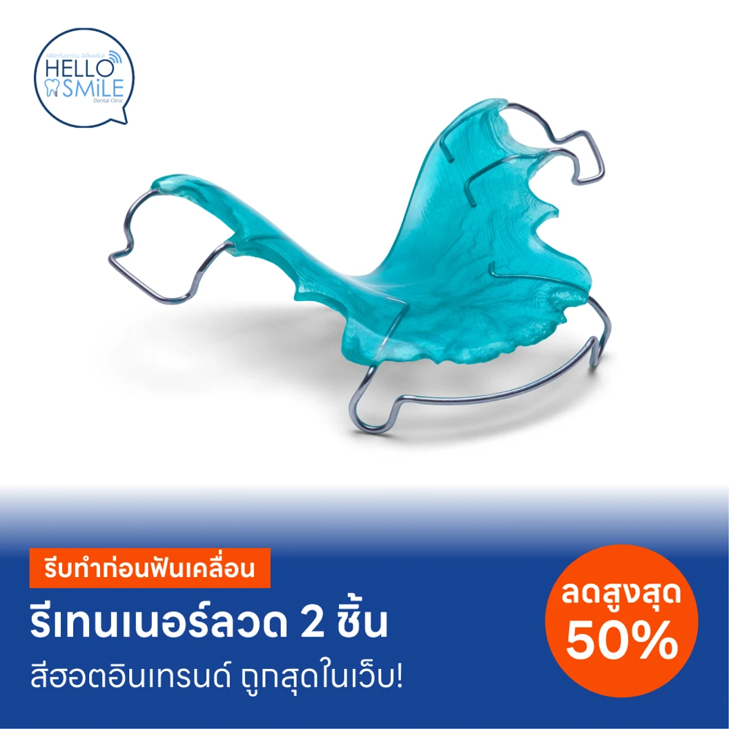 ทำรีเทนเนอร์แบบลวด 2 ชิ้น แพ็กเกจ HDmall+ ที่ Hello Smile Dental Clinic