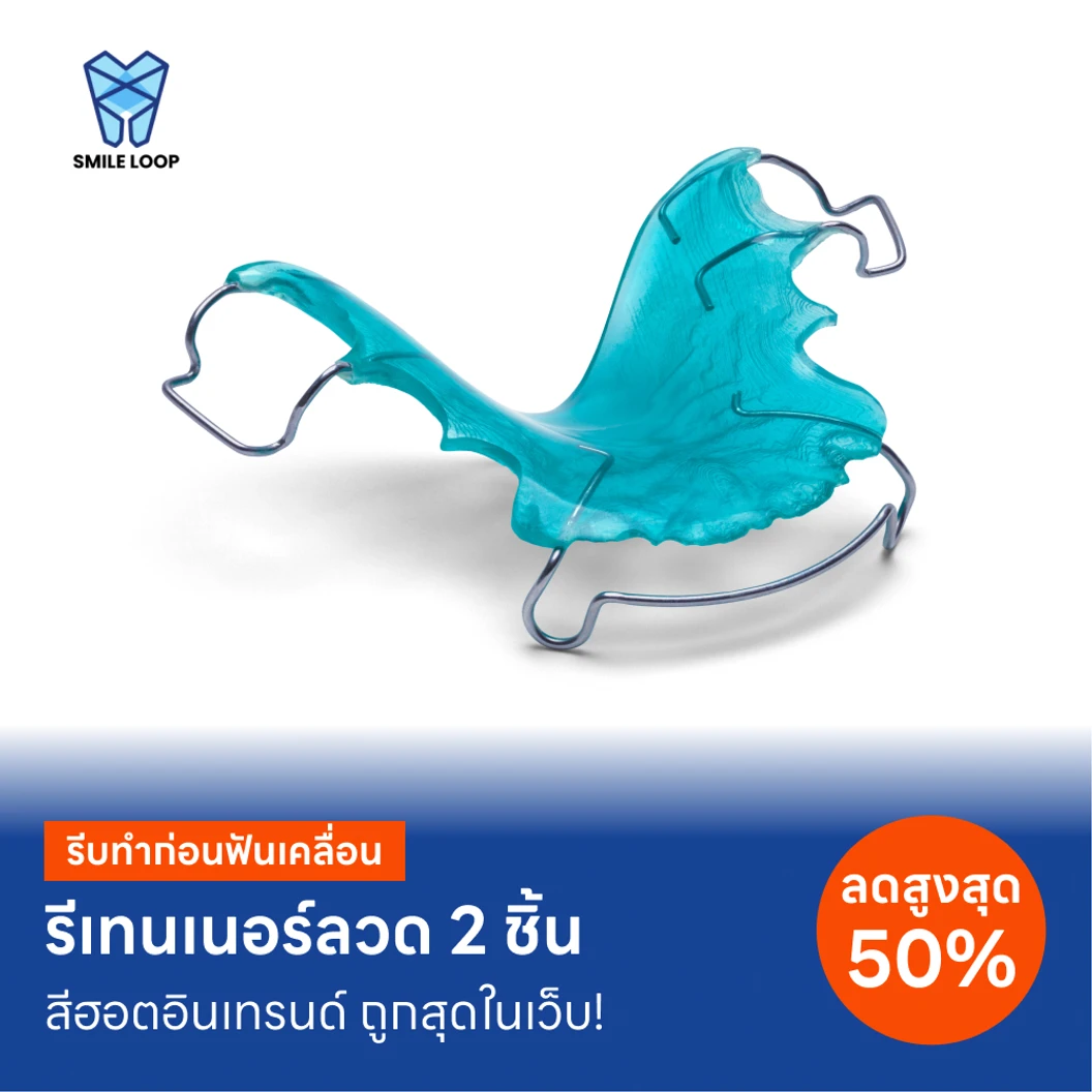 ทำรีเทนเนอร์แบบลวด 2 ชิ้น ฟันบนและล่าง แพ็กเกจ HDmall+ ที่ SMILE LOOP dental clinic คลินิกทันตกรรมสไมล์ลูป