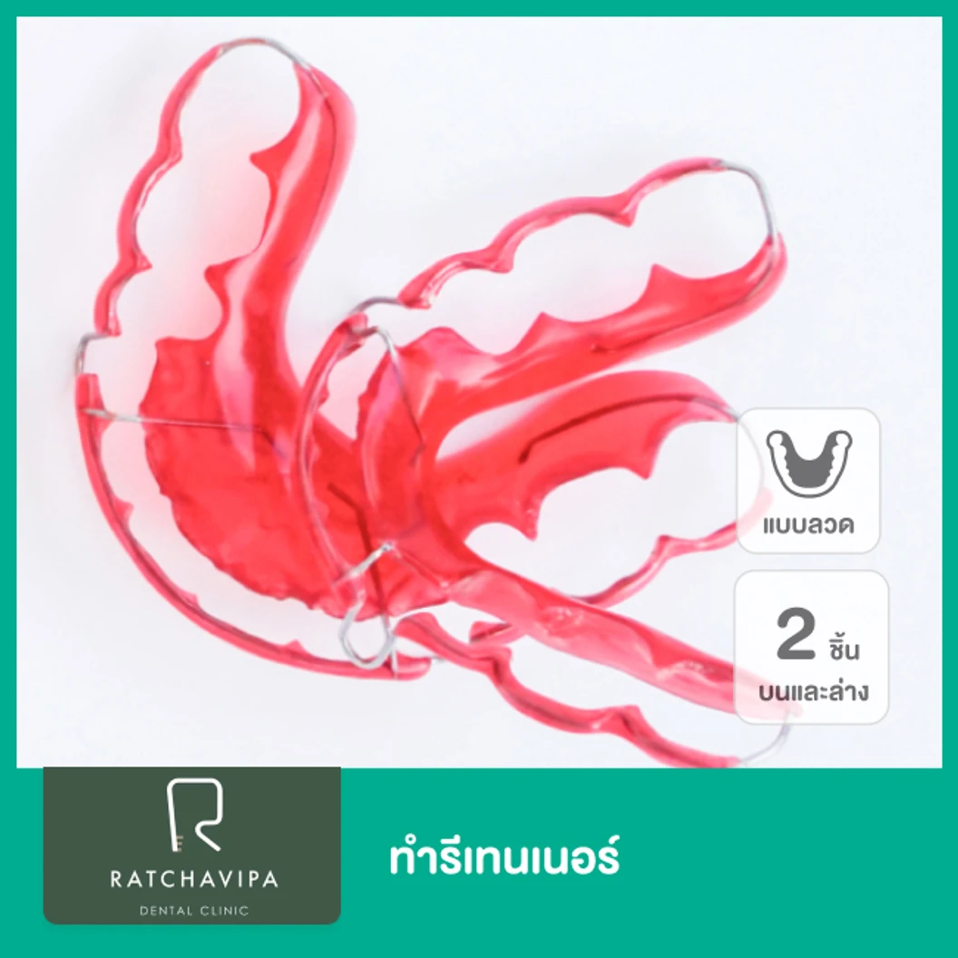 ทำรีเทนเนอร์แบบลวด 2 ชิ้น ฟันบนและล่าง ที่ Ratchavipa Dental Clinic คลินิกทันตกรรมรัชวิภา