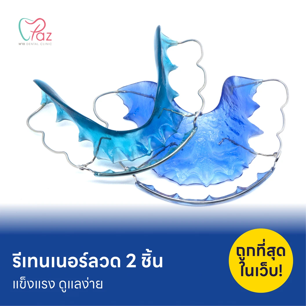 ทำรีเทนเนอร์แบบลวด 2 ชิ้น แพ็กเกจ HDmall+ ที่ Paz dental Clinic