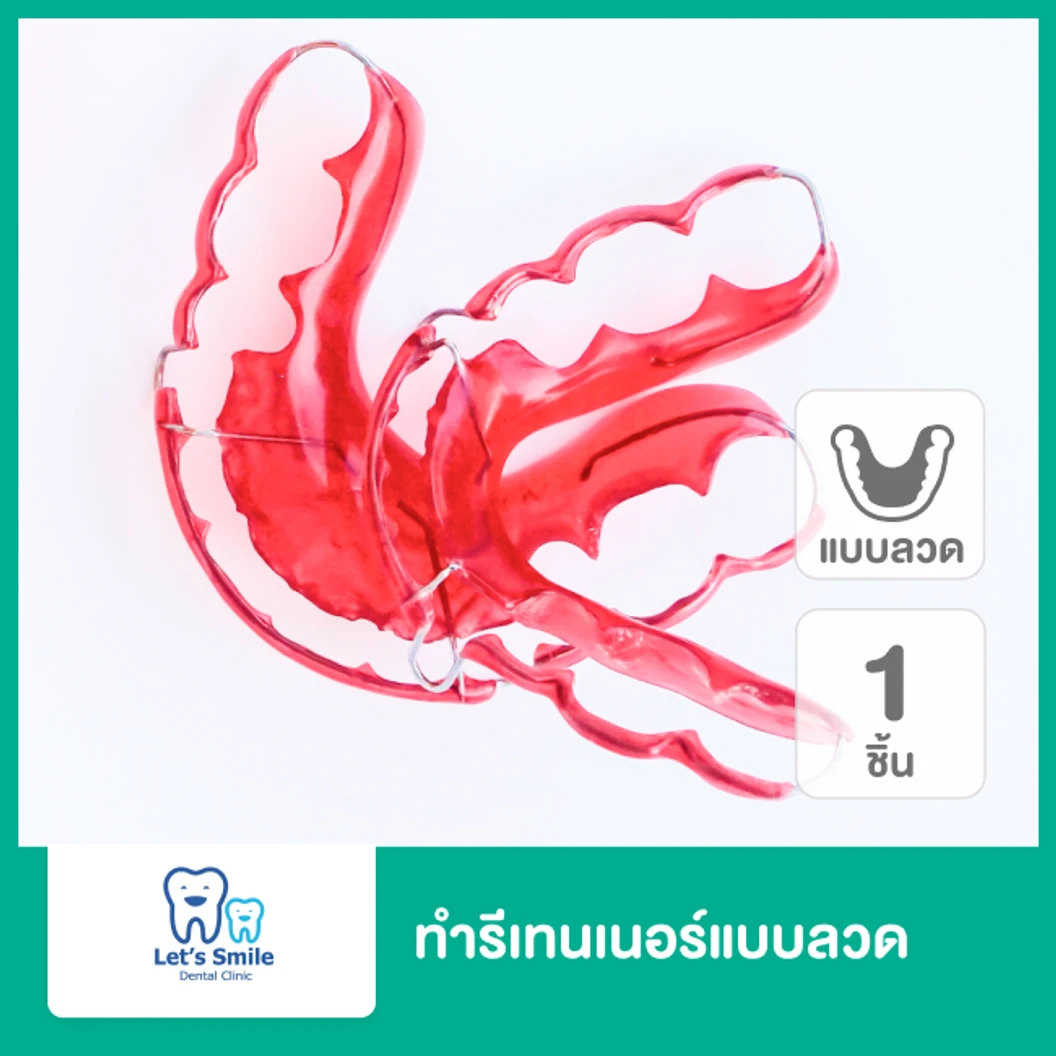 ทำรีเทนเนอร์แบบลวด 1 ชิ้น ฟันบนหรือล่าง  ที่ Lets Smile Dental Clinic