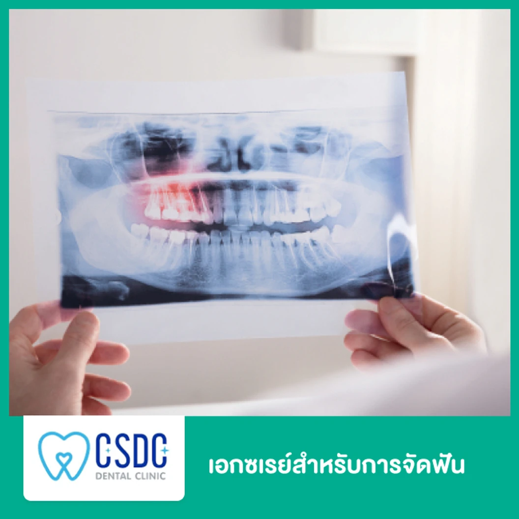 เอกซเรย์สำหรับการจัดฟัน ที่ CSDC