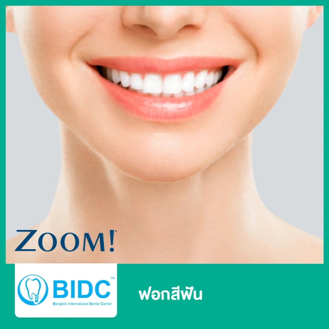ฟอกสีฟัน ด้วยระบบ Zoom ที่ BIDC Dental Center BIDC