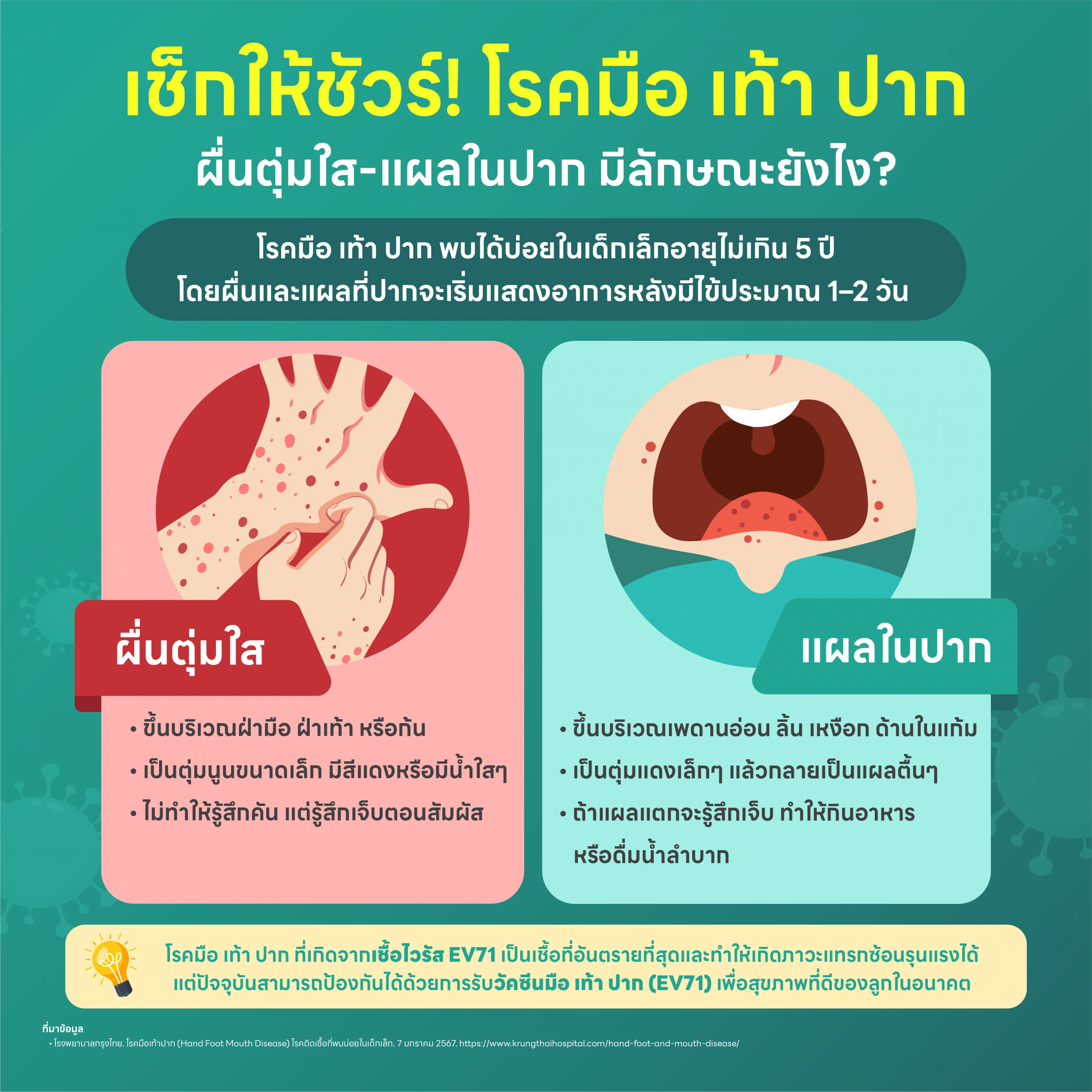 เช็กให้ชัวร์! ผื่นตุ่มใส แผลในปาก ใช่โรคมือ เท้า ปากหรือไม่? 3 อาการมือ เท้า ปาก
